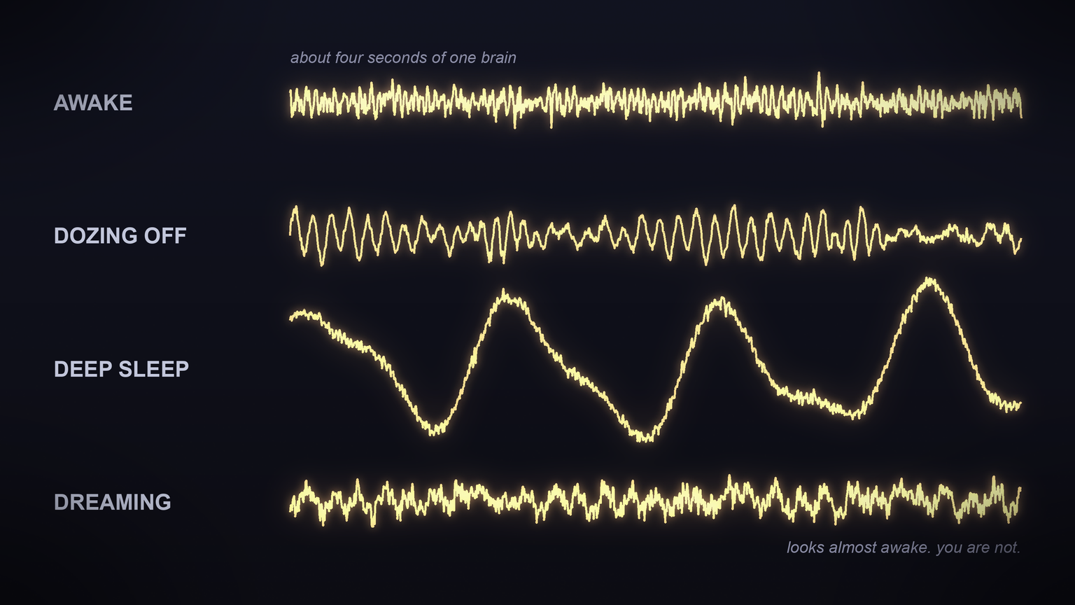 Four brain wave traces, one above the other, going from awake to deep sleep to dreaming. The dreaming one looks almost exactly like the awake one.